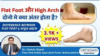 Flat Foot और High Arch दोनो मे क्या अंतर होता है? Difference Between Flat Foot & High Arch in Hindi