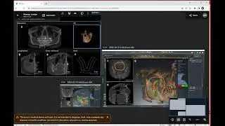DS Core: Canvas function