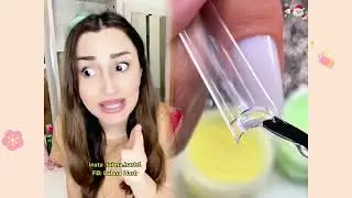 #الطفل الاعمى المعجزه #محضوره_من_الاكسبلور_والمشاهدات #علاوي_مارتن #اكسبلور 15_w🤣👌👌👌