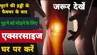 घुटने की हड्डी के फ्रैक्चर के बाद घुटने को मोड़ने के लिए करें एक्सरसाइज Knee Fracture Exercise