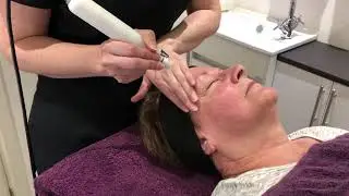 CACI Synergy Orbital Microdermabrasion at The Essentials