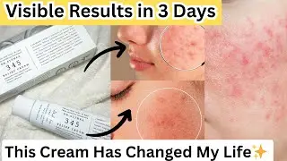 Dr Althea 345 Relief Cream Honest Review | Acne, Redness aur Dry Skin ka Hal