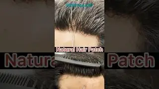 Premium Lace Hair Patch |Hair Patches for Men #hairwigsindelhi #shorts #viral #tiktok #reels #trend