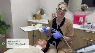 Radiesse, Sculptra, Moxi & Botox with Insiyah | Step-by-Step Treatment Guide