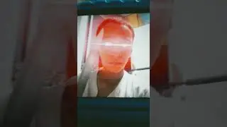 killer roland
