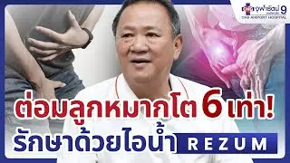 รีวิวรักษาต่อมลูกหมากโต ด้วยไอน้ำ (Rezum) เคส 