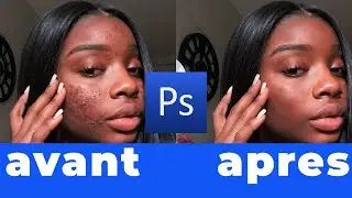 Comment retirer les boutons et imperfections sur un visage avec Photoshop - Tutoriel rapide