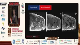 Fat Quantification as Imaging Biomarker