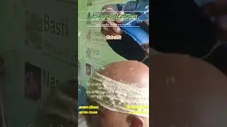 शिरोबस्ती Shirobasti Treatment