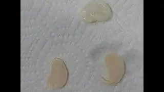 Lima bean seed dissection