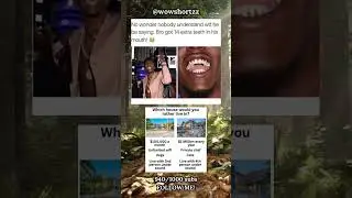 14 extra teeth? he crazy #viralshorts #dailyshorts