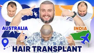 Hair Transplant in Chennai | Best Results & Cost of Hair Transplant in Chennai