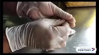 #Blood #glucose #measurement in #mice #antidiabetic #study