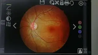 RetiCam 3100 fundus camera