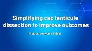Simplifying cap lenticule dissection to improve outcomes Dr. Jeewan S.Titiyal