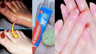 Colgate and lemon for hand and feet whitening cream | Colgate and lemon for skin whitening 