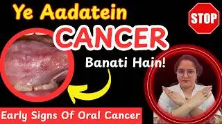 मुंह की कैंसर के शुरुवाती लक्षण | Signs of oral cancer | Mouth cancer symptoms in hindi |