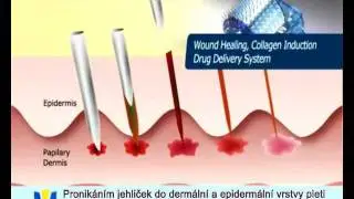 Etani Derma Roller. Kozmetick&yacute; v&aacute;leček Etani pro dom&aacute;c&iacute; použit&iacute;.