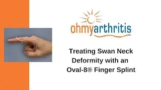 How to Treat a Swan Neck deformity with an Oval-8 Finger Splint - Oh My Arthritis