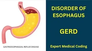 What is GERD| Medical coding course| reflux disease| Symptoms|Causes|Tests|Treatment|Precautions|ICD