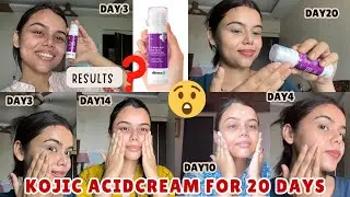 Kojic Acid Cream: The Hidden Solution for Hyperpigmentation
