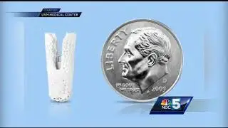 New technology fixes leaky heart valves without major surgery