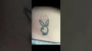 Playboy bunny laser tattoo removal Downtown Raleigh #lasertattooremoval
