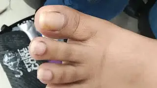Pedicure Modern #satisfying Neldz SOLO Parent  is live!