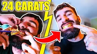 JE ME FAIT LES DENTS EN OR 24 CARATS ! Ft @Devovo