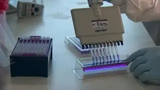 Detecting dementia - the simple blood test that could tell you if you're at risk