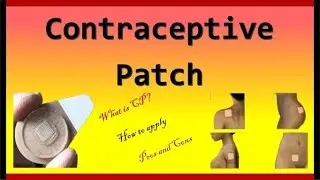 Contraceptive Patch for Birth Control / Evra Patch: Contraceptive Methods
