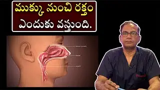 Bleeding From Nose | ముక్కు నుంచి రక్తం ఎందుకు వస్తుంది