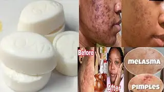 HOW ACTIVATE DOVE BAR SOAP INTO STRONG LIGHTENING SOAP// LEMON, HIBISCUS N ALOE VERA WHITENING SOAP