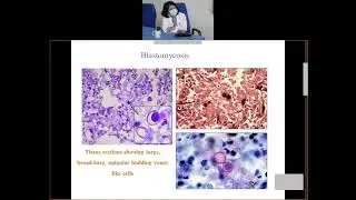 systemic mycoses by Dr. C. J Lyngdoh, NEIGHRIMS, Shillong