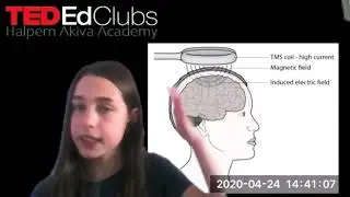 Beyond the Brain | Kayla Judkovski | Halpern Akiva Academy