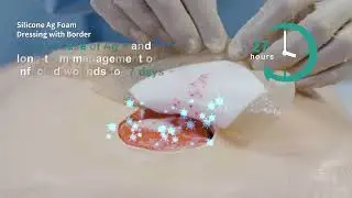 Dimora Silicone Foam Dressing Bordered Foam Wound Dressing 10cm x 10cm