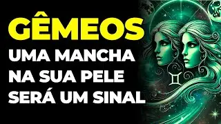 G&Ecirc;MEOS: 😢 UMA MANCHA NA SUA PELE SER&Aacute; UM SINAL | N&Atilde;O IGNORE | VOC&Ecirc; VAI SE ARREPENDER...