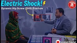 Dynamic Hip Screw (DHS)||Dr Prakash Kumar MBBS MS ortho||Electric shock 🫨