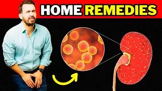 Foods and UTIs: What to Eat to Prevent Urine Infections