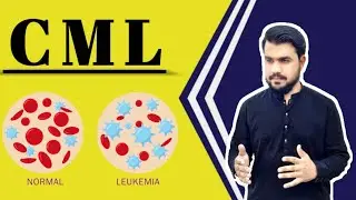 what is chronic myeloid leukemia | symptoms of CML | granulocytic leukemia