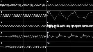 [YM2612 + 4&times;Generic PCM DAC, Furnace Tracker] Sonic the Hedgehog 2 - Mystic Cave Zone