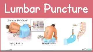 Lumbar Puncture (Spinal Tap) Explained | Anatomy, Procedure, Indications and Contraindications