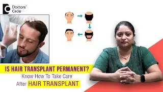 Is Hair Transplant permanent? | Dos & Don'ts after Hair Transplant -Dr.Ramya Deepthi|Doctors' Circle