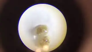 Live black bugs in Coral Revive dip