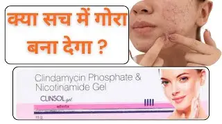 Clinsol gel | इस्तेमाल करने का सही तरीका | Acne | Pimples
