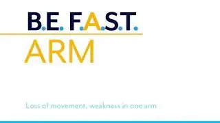 BE FAST: Do You Know The Signs of A Stroke? SOCIAL