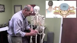 Dr. Strubbe Pinellas Park Chiropractor, Disc problems, back pain, doctor, back and neck care