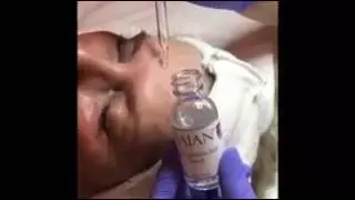 Rezenerate Facial