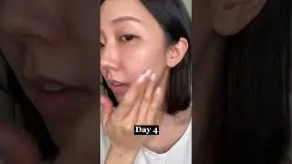 SOS Serum for my Troubled Skin #julioly #skincare #skincareroutine #athome