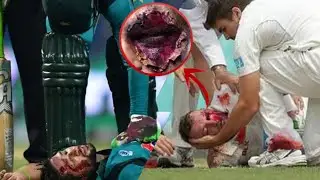 Famous cricketer who died during match ||مشہور کرکٹرز جو میچ کے دوران  مرگئے